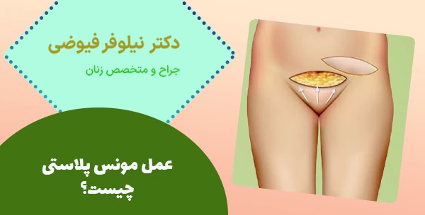 عمل مونس پلاستی چیست؟