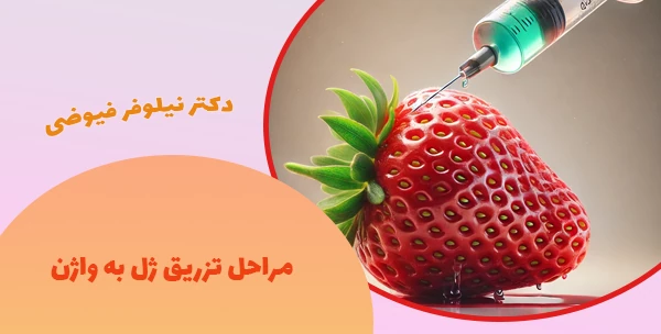مراحل تزریق ژل به واژن
