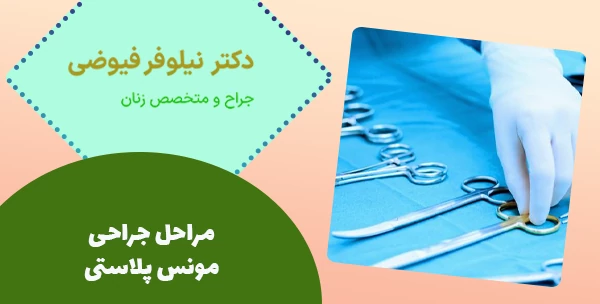 مراحل جراحی مونس پلاستی