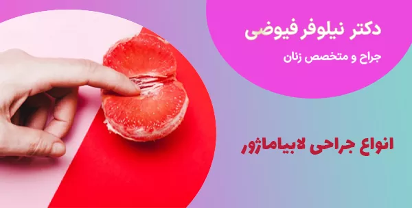 انواع جراحی لابیاماژور