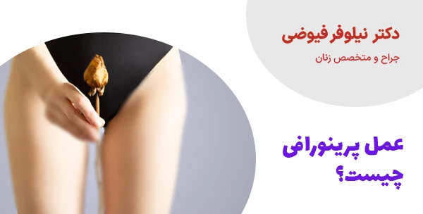 عمل پرینورافی چیست؟