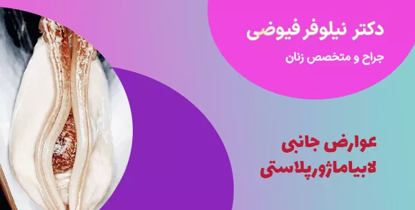 عوارض جانبی لابیاماژورپلاستی