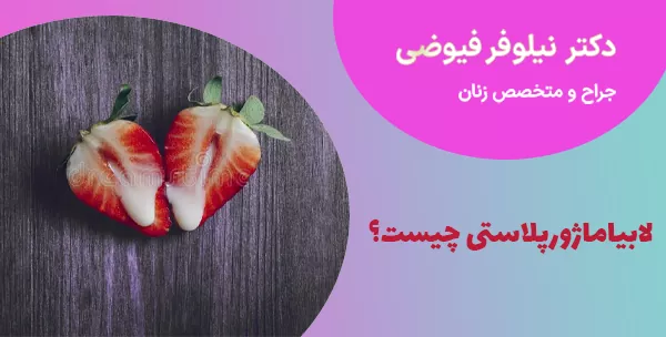 لابیاماژورپلاستی چیست؟
