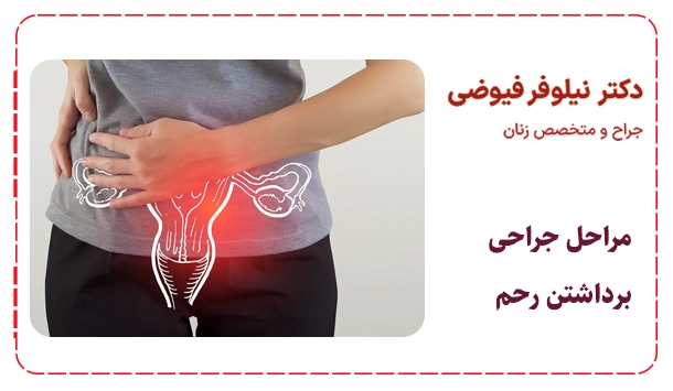 مراحل جراحی برداشتن رحم