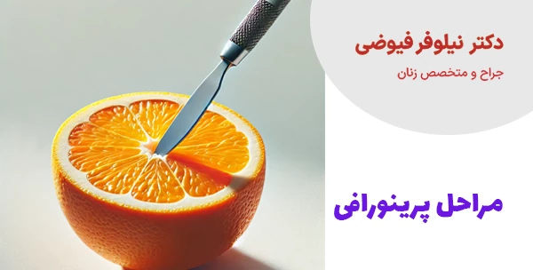 مراحل پرینورافی
