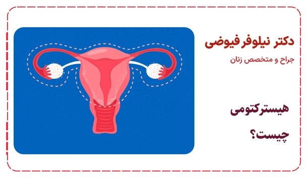 هیسترکتومی چیست؟