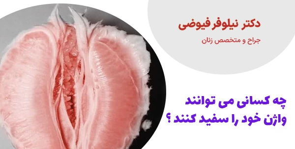 چه کسانی می توانند واژن خود را سفید کنند ؟