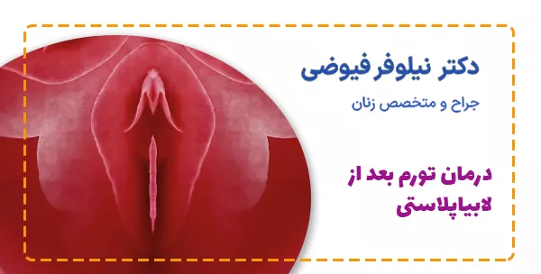 درمان تورم بعد از لابیاپلاستی