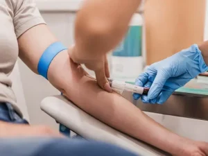 آزمایشات قبل از لابیاپلاستی