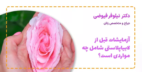 آزمایشات قبل از لابیاپلاستی شامل چه مواردی است؟