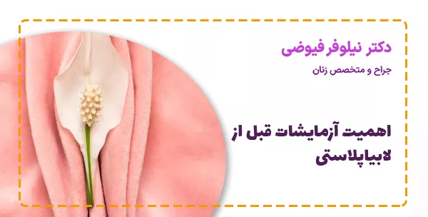 اهمیت آزمایشات قبل از لابیاپلاستی