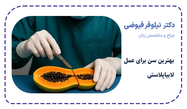 بهترین سن برای عمل لابیاپلاستی