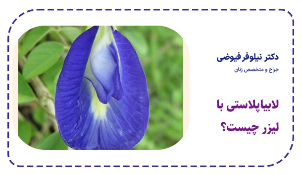 لابیاپلاستی با لیزر چیست؟