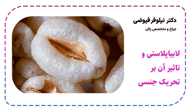 لابیاپلاستی و تاثیر آن بر تحریک جنسی