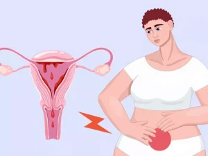 پریود بعد از لابیاپلاستی