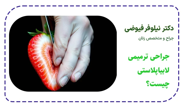 جراحی ترمیمی لابیاپلاستی چیست؟