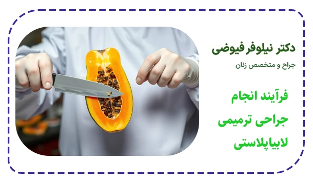 فرآیند انجام جراحی ترمیمی لابیاپلاستی