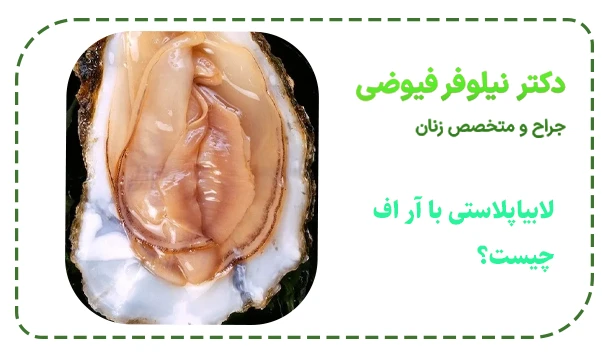 لابیاپلاستی با آر اف چیست؟