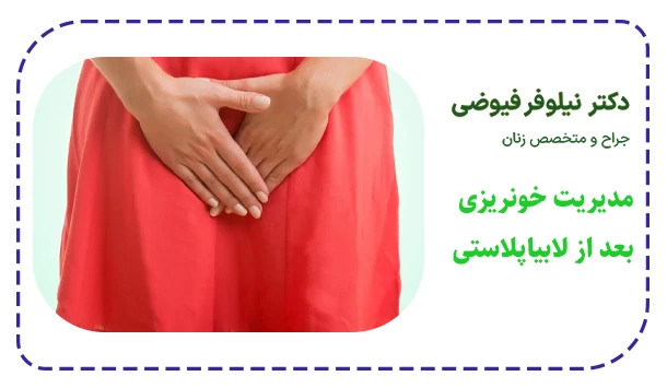 مدیریت خونریزی بعد از لابیاپلاستی
