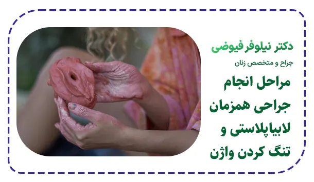 مراحل انجام جراحی همزمان لابیاپلاستی و تنگ کردن واژن