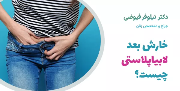 خارش بعد لابیاپلاستی چیست؟
