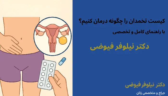 درمان کیست تخمدان
