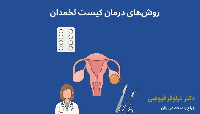 روشذ های درمان کیست تخمدان