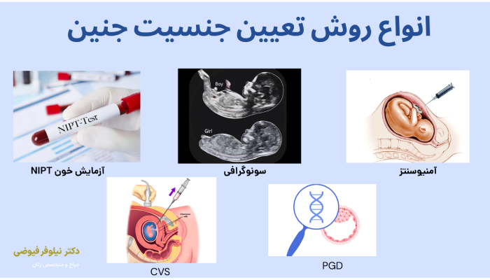انواع روش تعیین جنسیت جنین