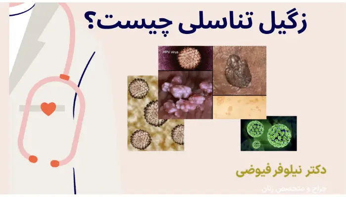 زگیل تناسلی چیست؟