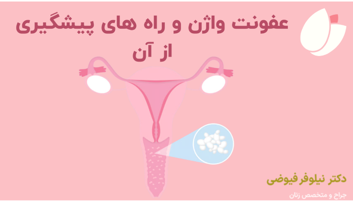 عفونت واژن و راه های پیشگیری از آن