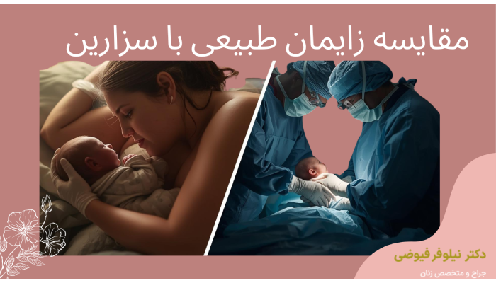مقایسه زایمان طبیعی با سزارین