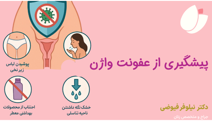 پیشگیری از عفونت واژن