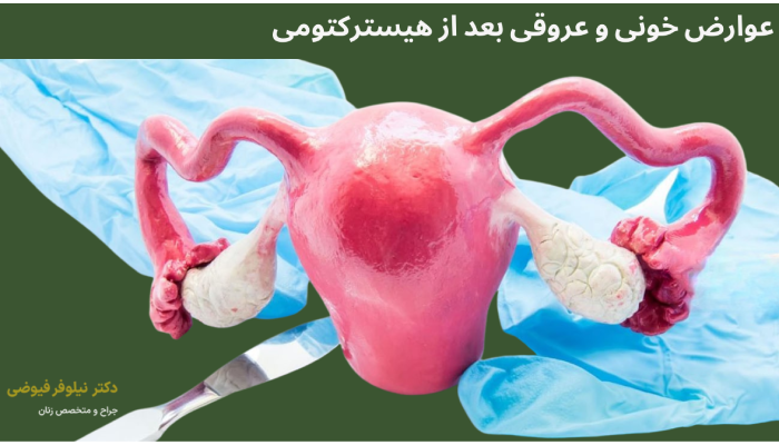 عوارض خونی و عروقی بعد از جراحی هیسترکتومی