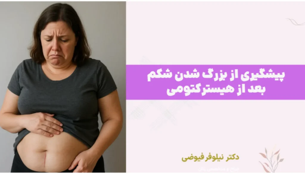 پیشگیری از بزرگ شدن شکم بعد از هیسترکتومی