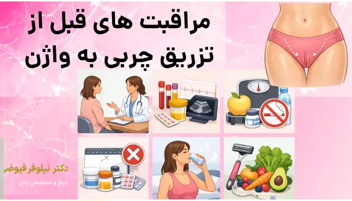 مراقبت های قبل از تزریق تزریق چربی به واژن